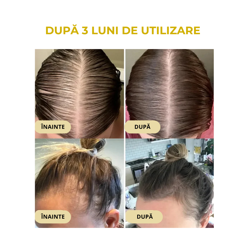 SER DE PĂR ȘI SCALP PENTRU CREȘTEREA PĂRULUI