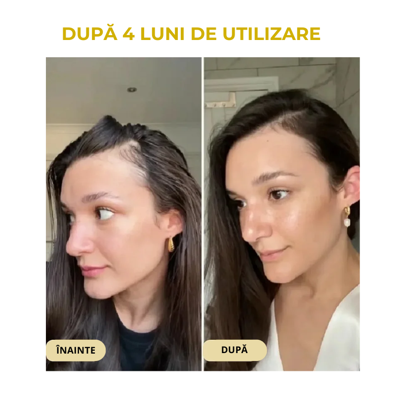 SER DE PĂR ȘI SCALP PENTRU CREȘTEREA PĂRULUI