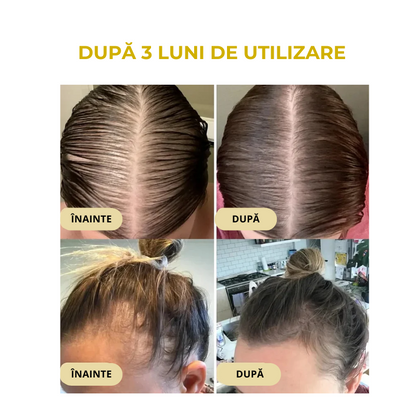 SER DE PĂR ȘI SCALP PENTRU CREȘTEREA PĂRULUI